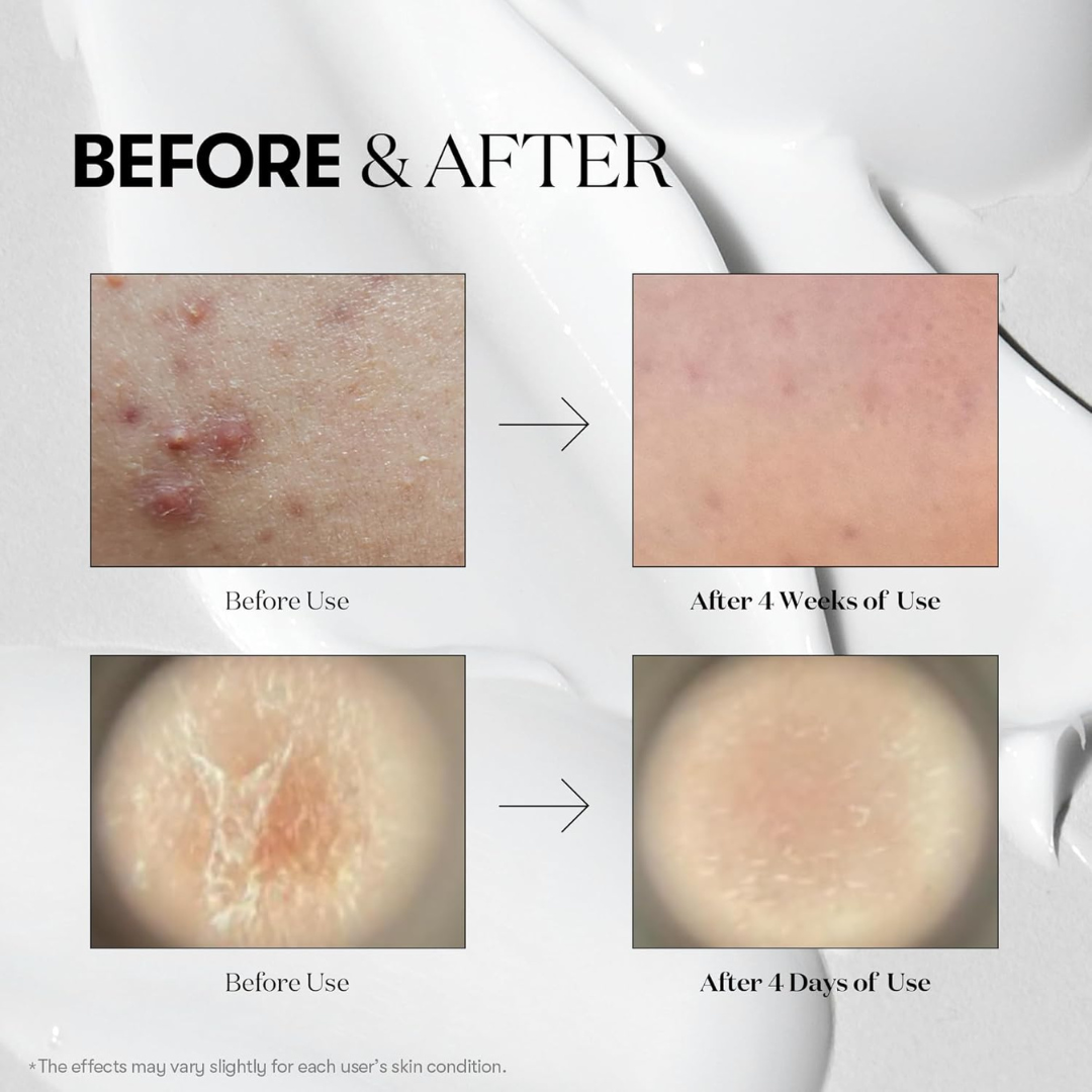 Serum - VT Cica Reedle Shot 100