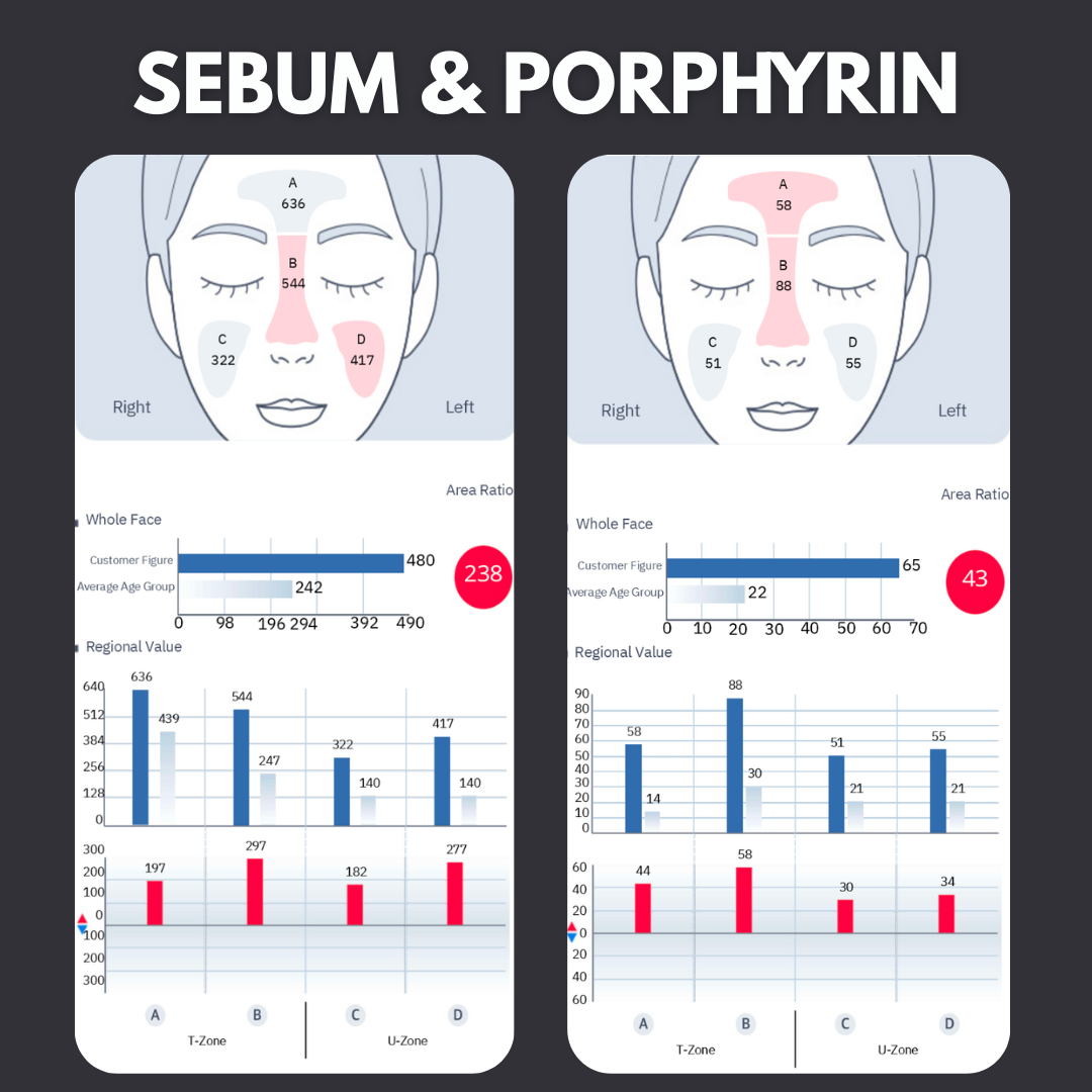 Skin Analysis Session (In Person)