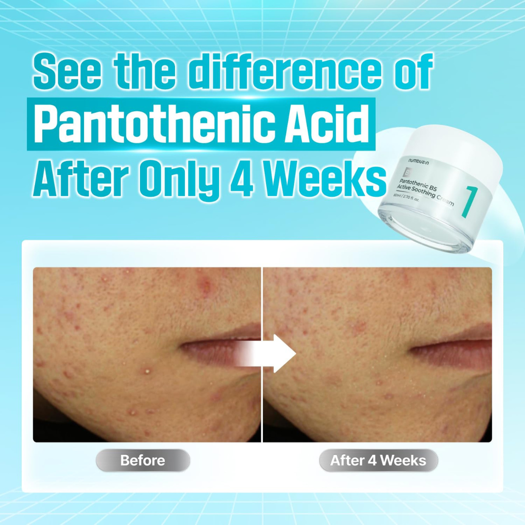 Moisturizer - Numbuzin No. 1 Pantothenic B5 Active Soothing Cream