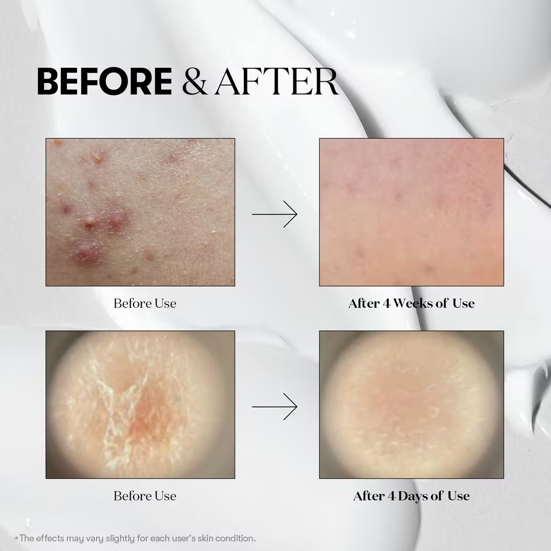 Serum - VT Cica Reedle Shot 300