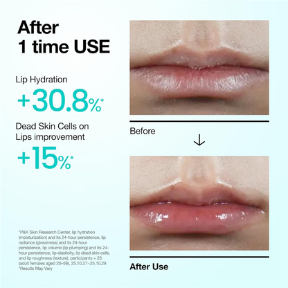 Lip Care - Anua PDRN Hyaluronic Acid Lip Serum