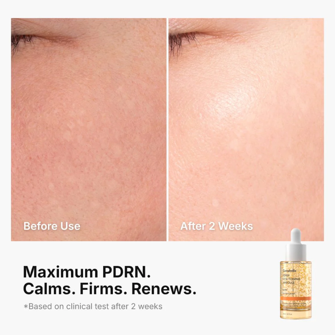 Serum - Genabelle PDRN Vita Toning Ampoule