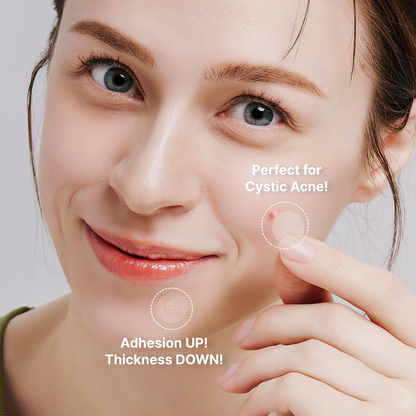 Treatment - Acropass AcneCure DEN Microarray Patch