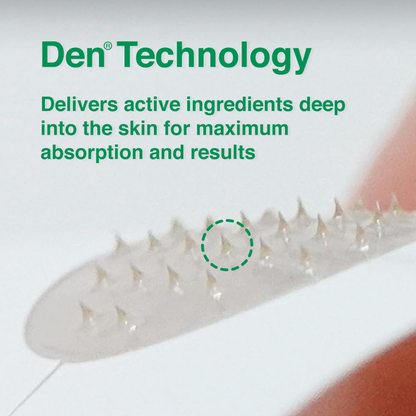 Treatment - Acropass AcneCure DEN Microarray Patch