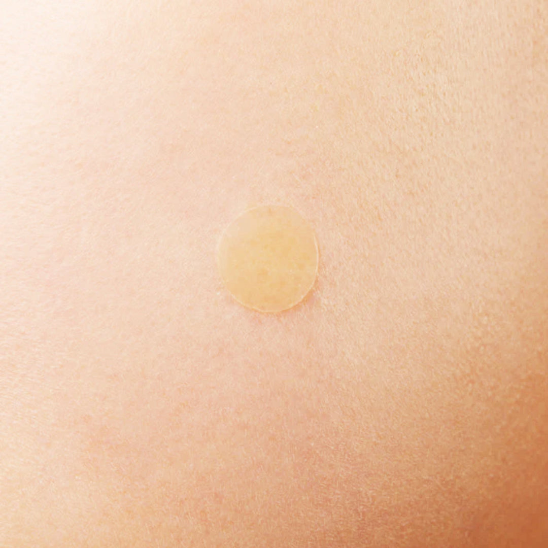 Treatment - COSRX Acne Pimple Master Patch