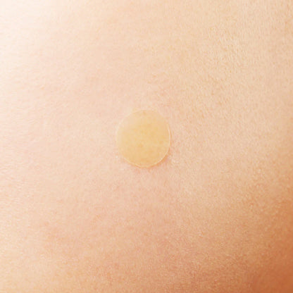 Treatment - COSRX Acne Pimple Master Patch