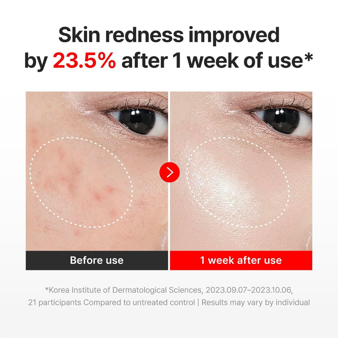 Moisturizer - Centellian24 Madeca Time Reverse