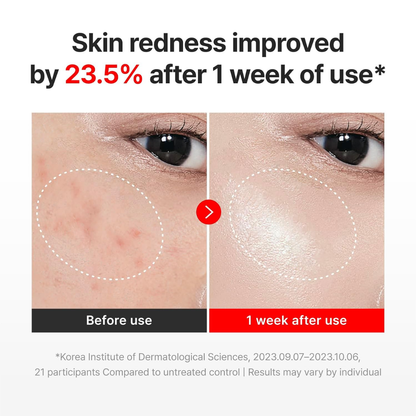 Moisturizer - Centellian24 Madeca Time Reverse