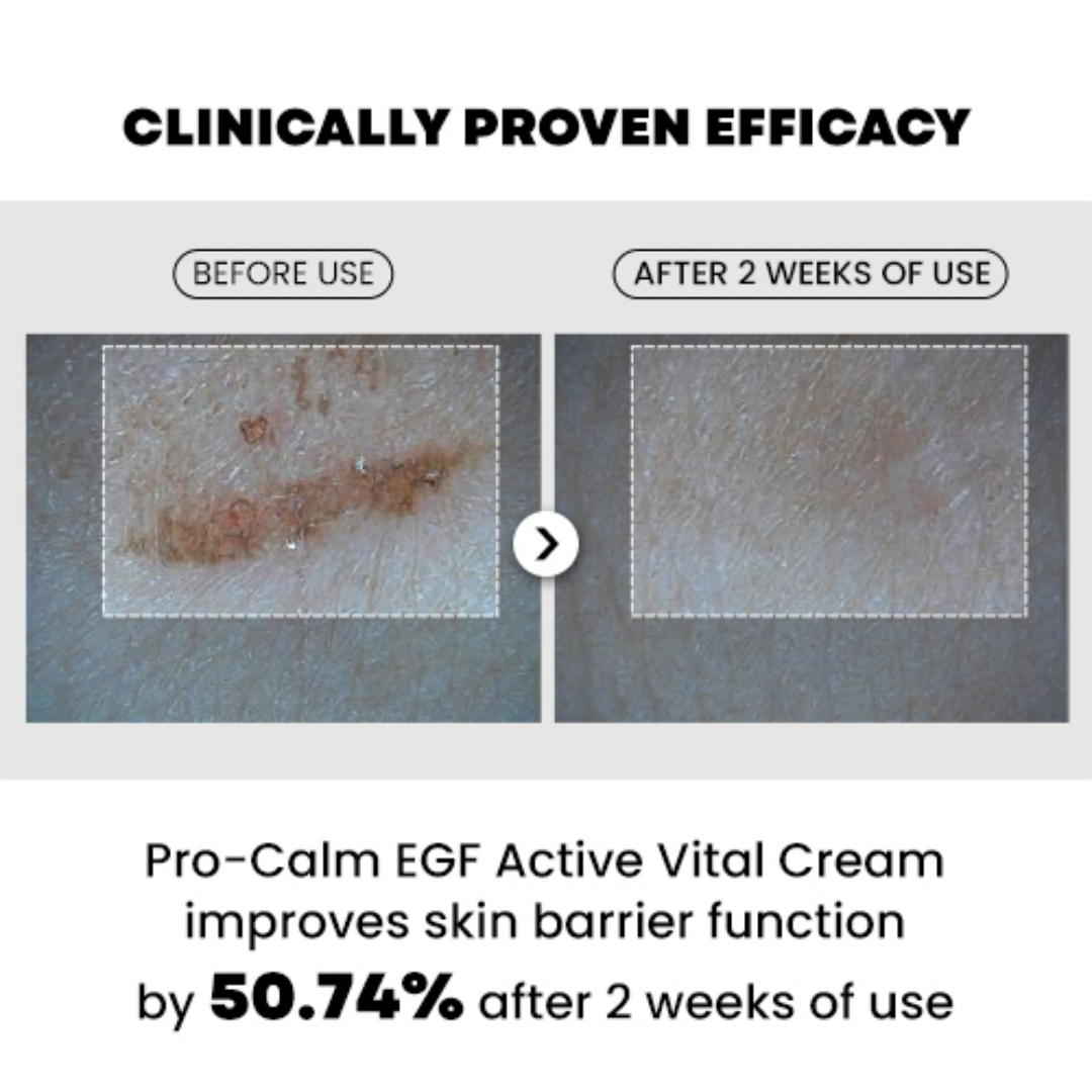 Moisturizer - Pro-Calm EGF Active vital cream