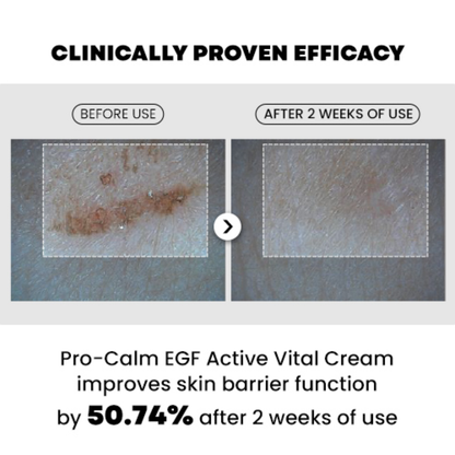 Moisturizer - Pro-Calm EGF Active vital cream