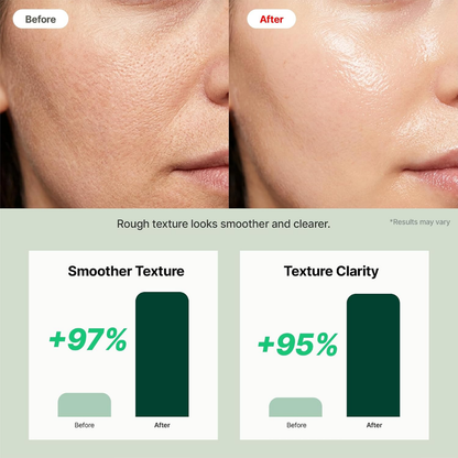 Exfoliator - Raume Cerafit Time Deep Peeling Gel Cream