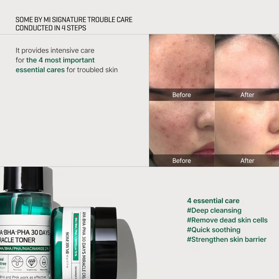 Some By Mi AHA BHA PHA 30-Days Miracle Starter Kit