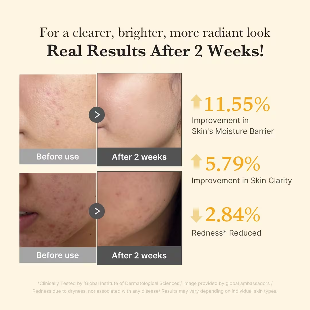 Serum - Medicube Kojic Acid Turmeric Niacinamide Serum