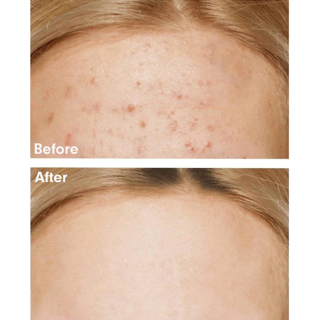 Moisturizer - Some By Mi AHA-BHA-PHA 30 Days Miracle Cream