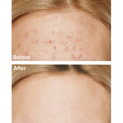 Moisturizer - Some By Mi AHA-BHA-PHA 30 Days Miracle Cream